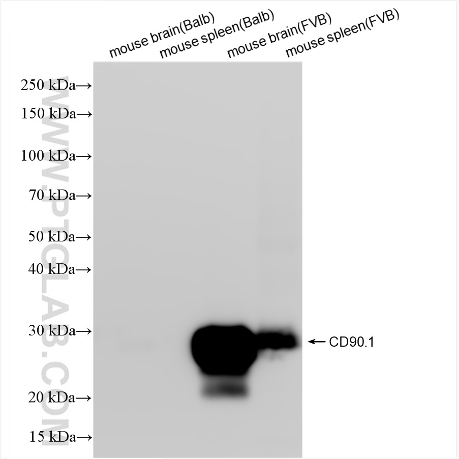 Western Blot (WB) analysis of various lysates using CD90.1 Recombinant antibody (84832-1-RR)
