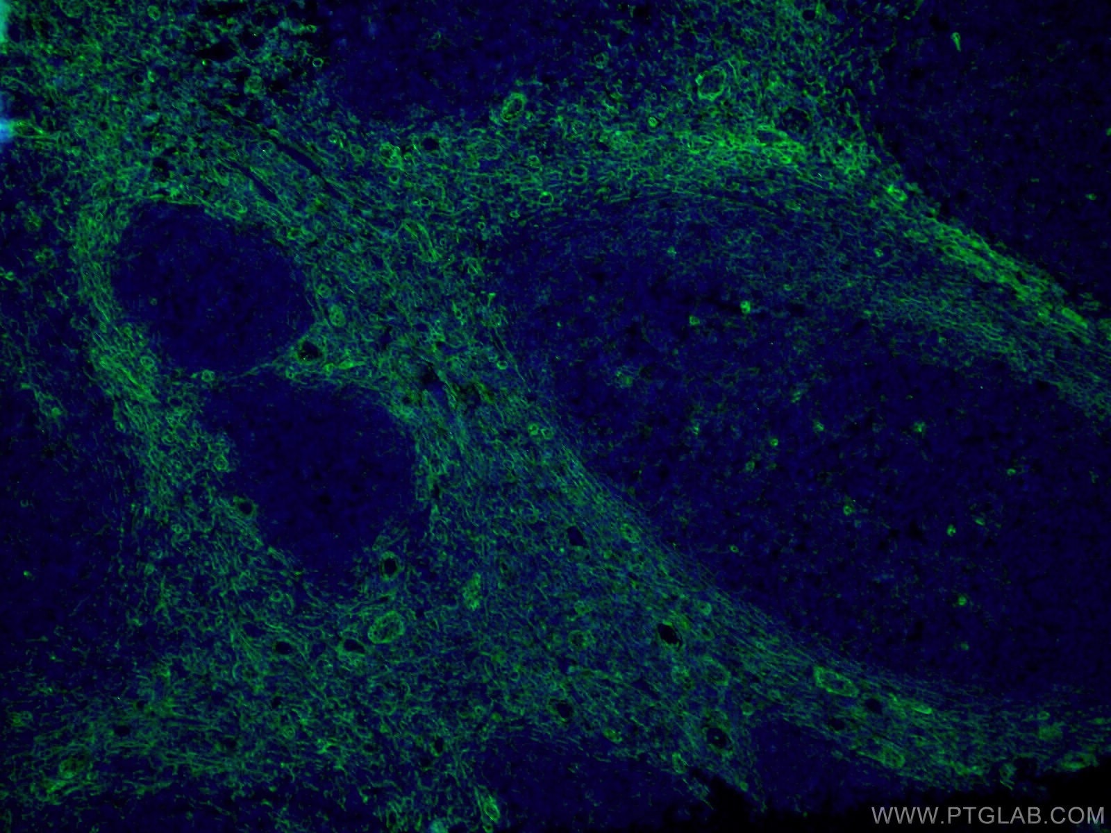 Immunofluorescence (IF) / fluorescent staining of human tonsillitis tissue using CD90 Monoclonal antibody (66766-1-Ig)