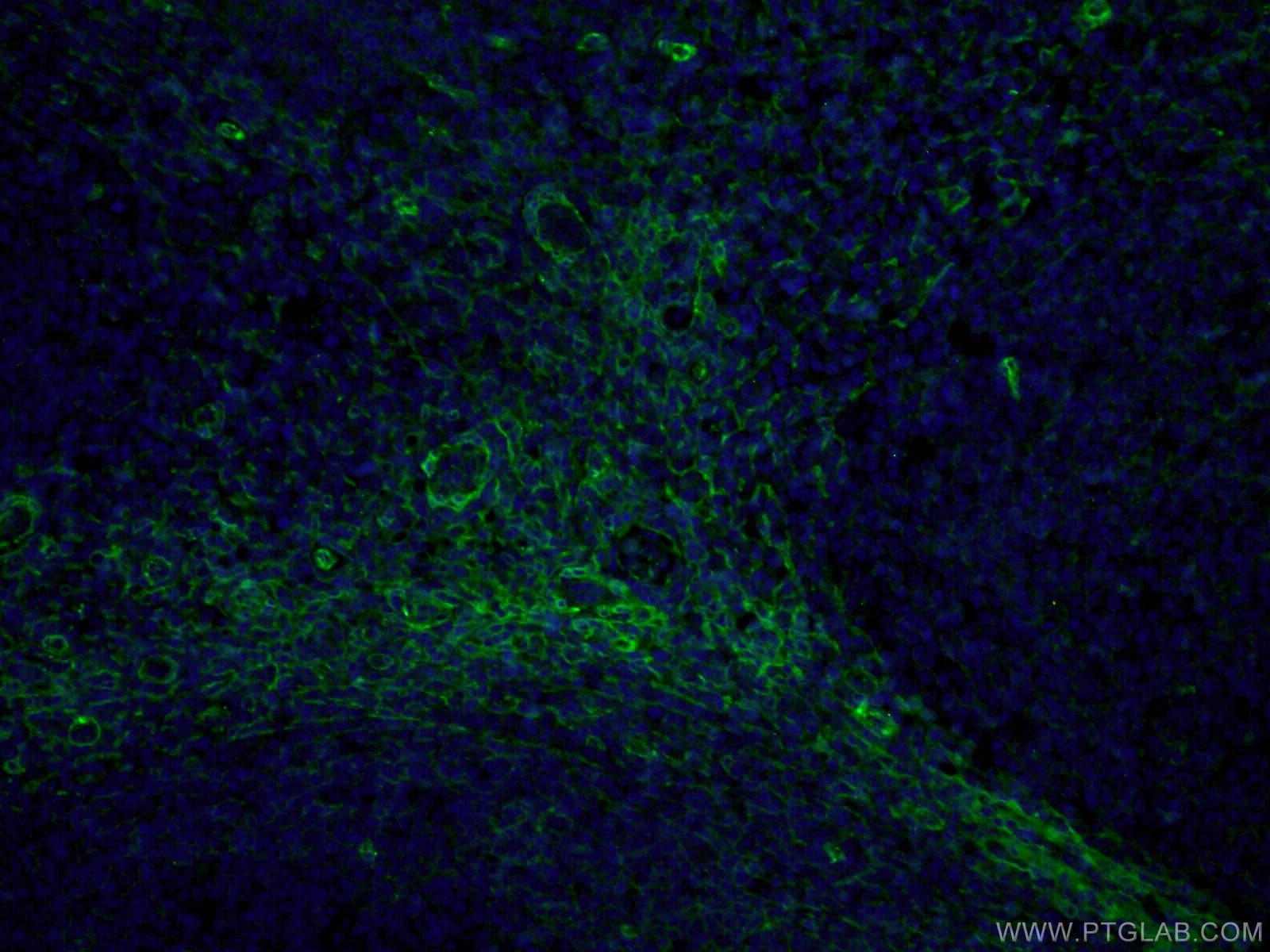 Immunofluorescence (IF) / fluorescent staining of human tonsillitis tissue using CD90 Monoclonal antibody (66766-1-Ig)
