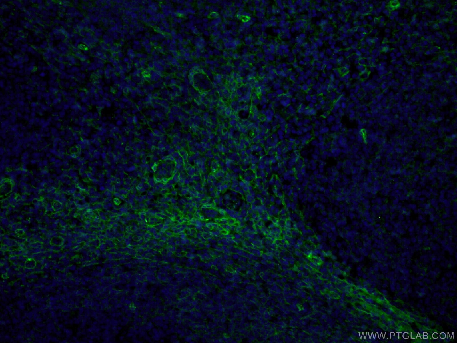 IF Staining of human tonsillitis using 66766-1-Ig