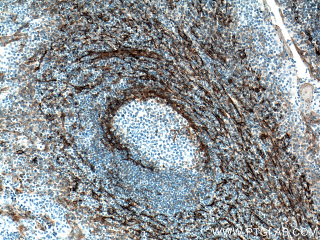 Immunohistochemistry (IHC) staining of human tonsillitis tissue using CD90 Monoclonal antibody (66766-1-Ig)