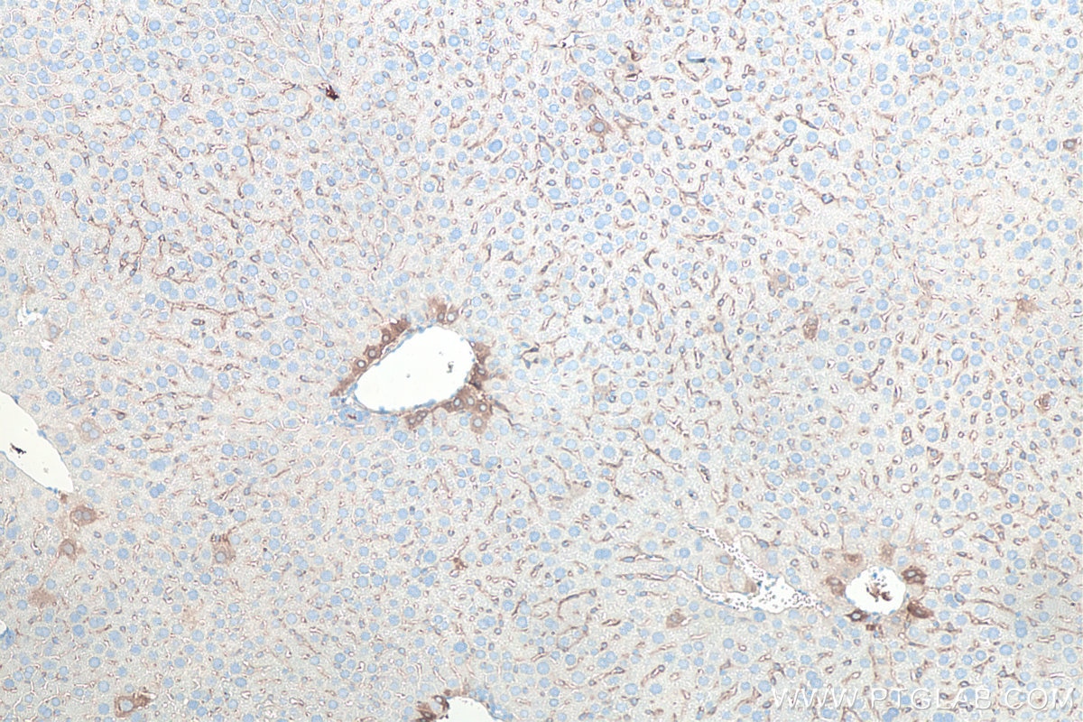 Immunohistochemistry (IHC) staining of mouse liver tissue using CD90 Monoclonal antibody (66766-1-Ig)