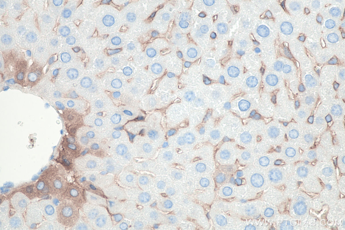 Immunohistochemistry (IHC) staining of mouse liver tissue using CD90 Monoclonal antibody (66766-1-Ig)