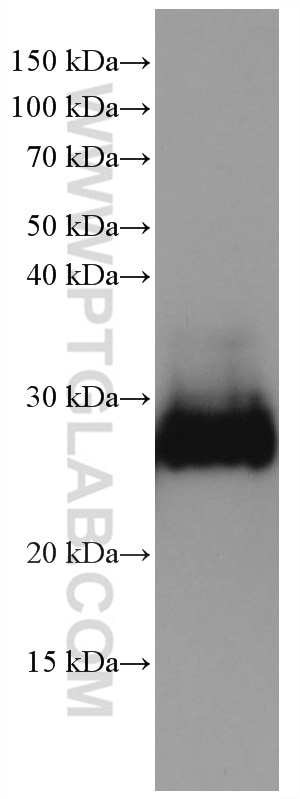 Western Blot (WB) analysis of human kidney tissue using CD90 Monoclonal antibody (66766-1-Ig)