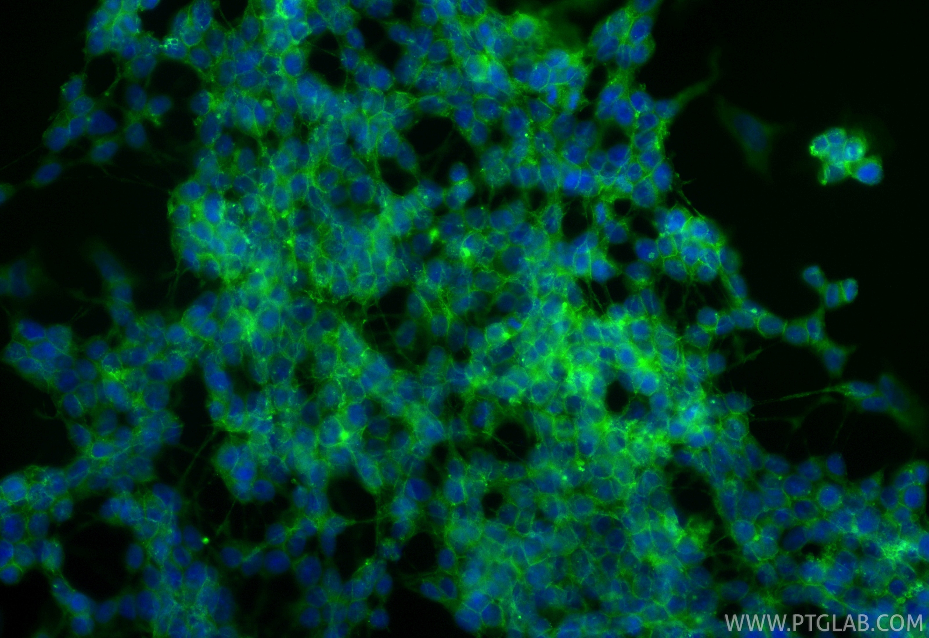 Immunofluorescent analysis of (-20°C Ethanol) fixed SH-SY5Y cells using CoraLite® Plus 488 CD90 antibody (CL488-84180, Clone: 241290B1 ) at dilution of 1:200. Immunofluorescence (IF) / fluorescent staining of SH-SY5Y cells using CoraLite® Plus 488-conjugated CD90 Recombinant mon (CL488-84180)