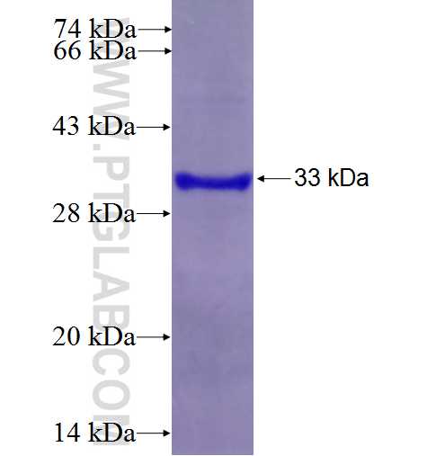 CD90 fusion protein Ag25603 SDS-PAGE