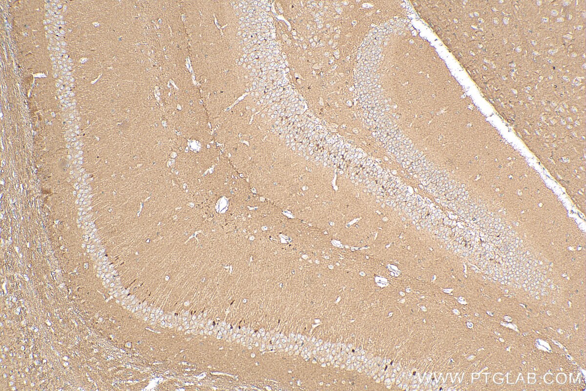 Immunohistochemistry (IHC) staining of mouse brain tissue using CD90 / Thy1 Polyclonal antibody (27178-1-AP)