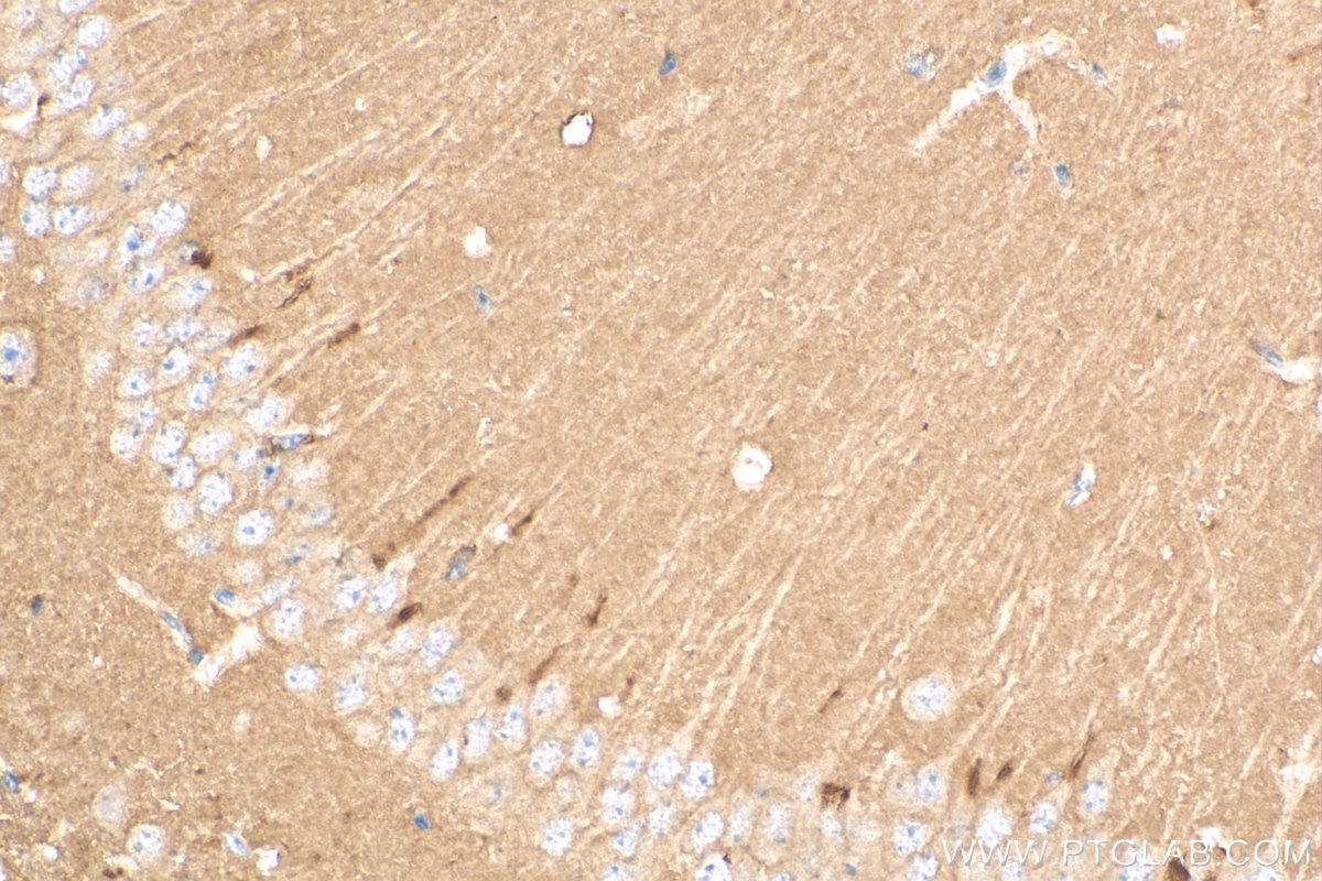 Immunohistochemistry (IHC) staining of mouse brain tissue using CD90 / Thy1 Polyclonal antibody (27178-1-AP)