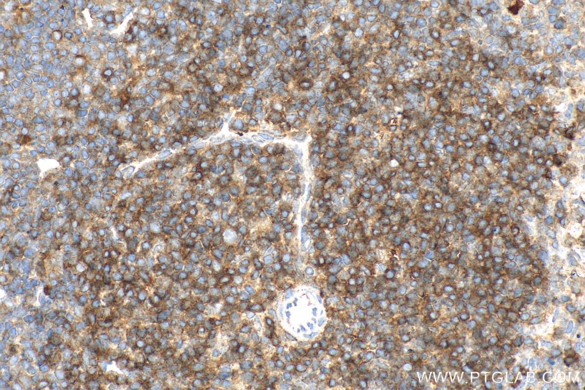 IHC staining of mouse spleen using 27178-1-AP