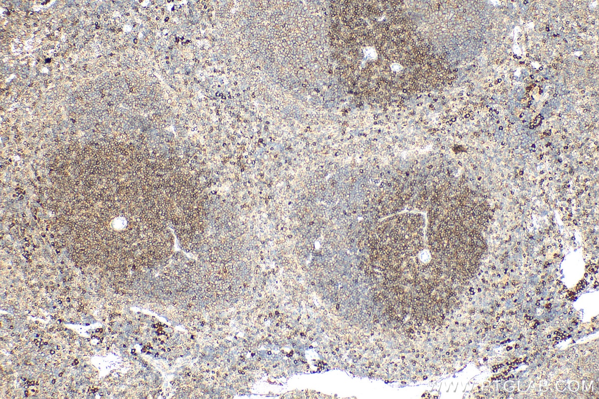 Immunohistochemistry (IHC) staining of mouse spleen tissue using CD90 / Thy1 Polyclonal antibody (27178-1-AP)