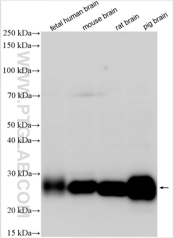 Western Blot (WB) analysis of various lysates using CD90 / Thy1 Polyclonal antibody (27178-1-AP)