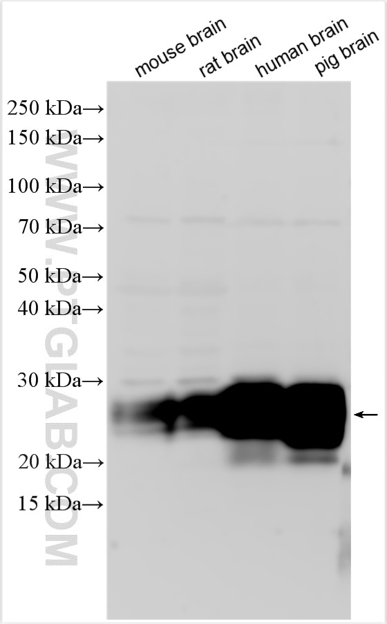 Western Blot (WB) analysis of various lysates using CD90 / Thy1  Polyclonal antibody (27770-1-AP)