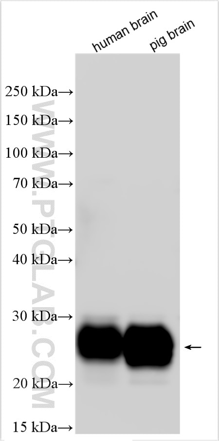 Western Blot (WB) analysis of various lysates using CD90 / Thy1  Polyclonal antibody (27770-1-AP)