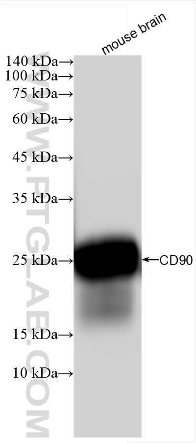 Western Blot (WB) analysis of various lysates using CD90 Recombinant antibody (85677-1-RR)