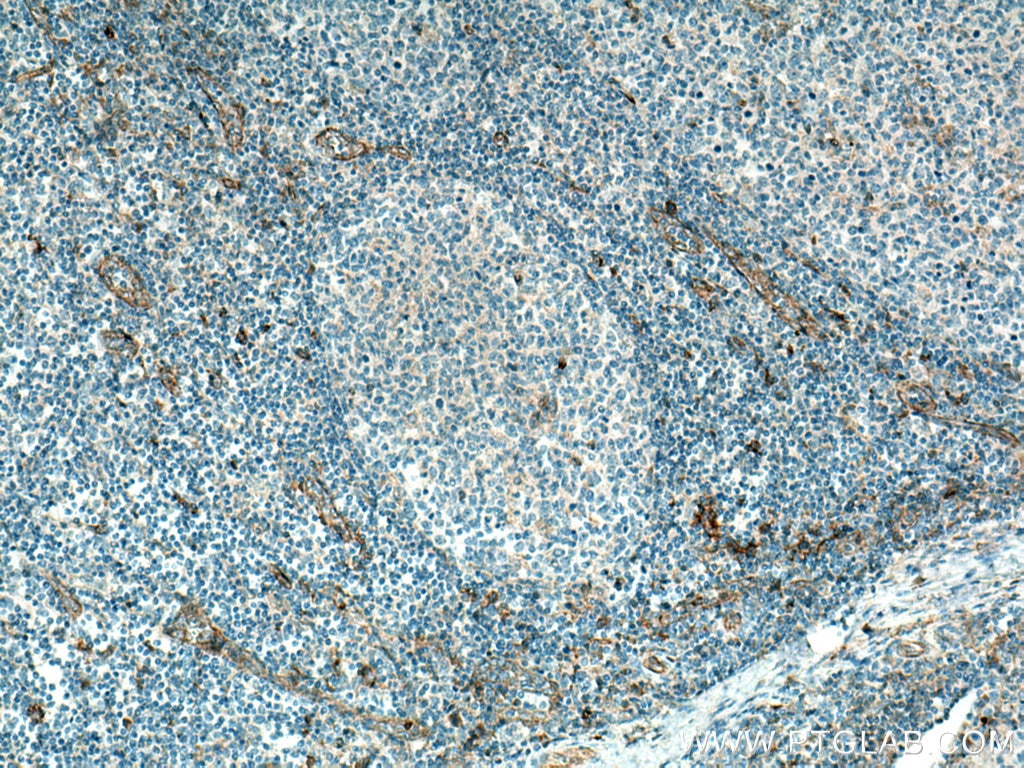 Immunohistochemistry (IHC) staining of human tonsillitis tissue using CD93 Polyclonal antibody (18283-1-AP)