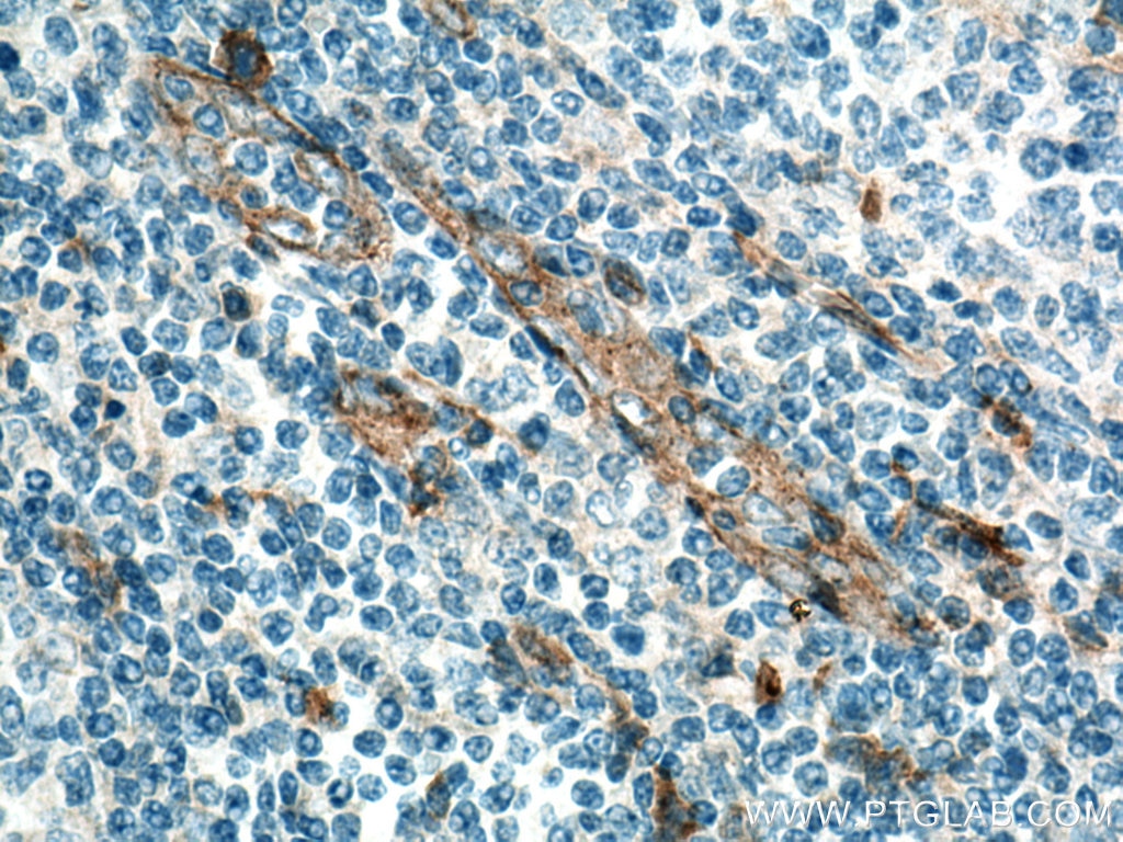Immunohistochemistry (IHC) staining of human tonsillitis tissue using CD93 Polyclonal antibody (18283-1-AP)