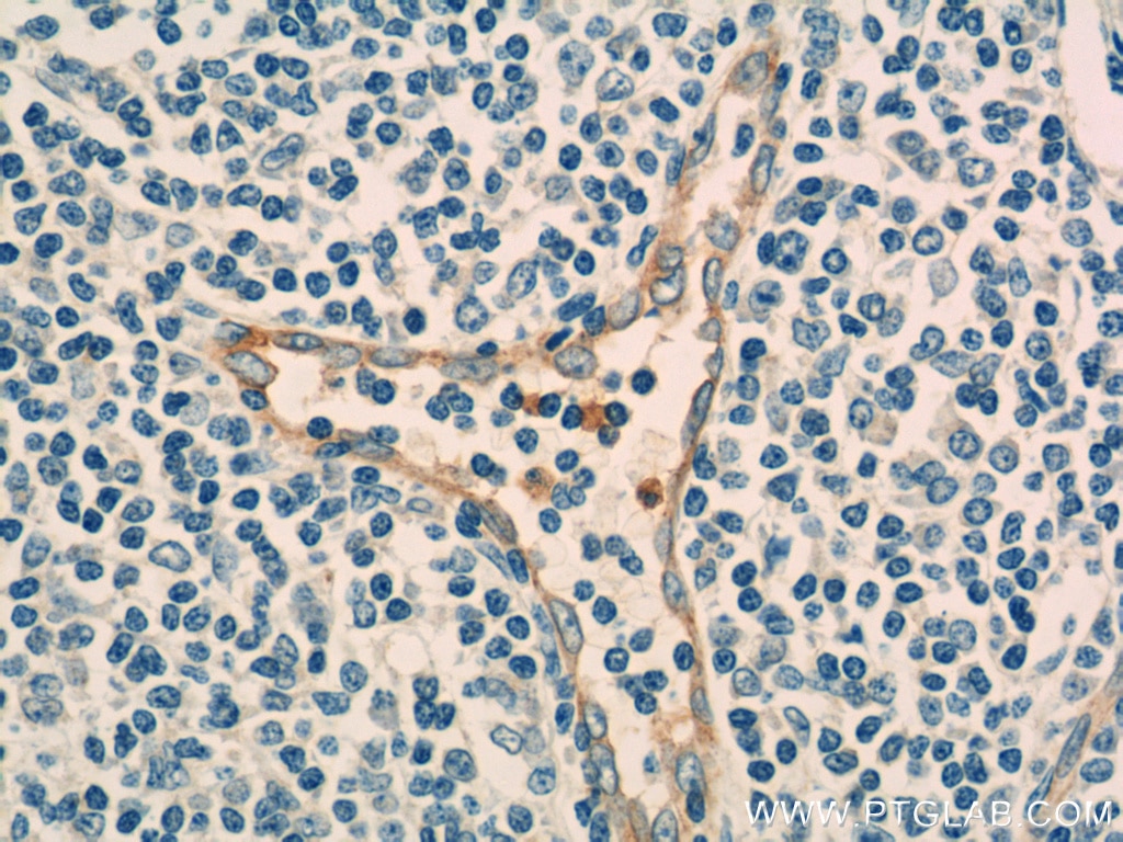 CD93 Polyclonal antibody