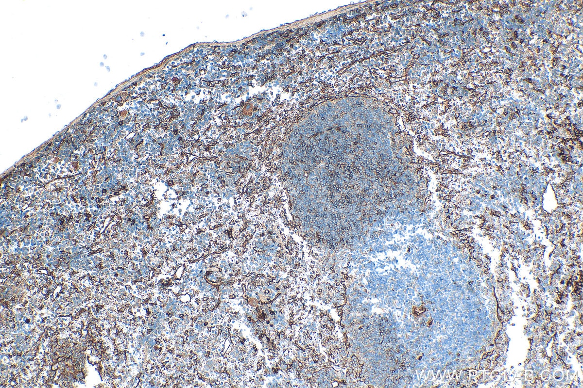 IHC staining of mouse spleen using 33313-1-AP Immunohistochemistry (IHC) staining of mouse spleen tissue using CD93 Polyclonal antibody (33313-1-AP)