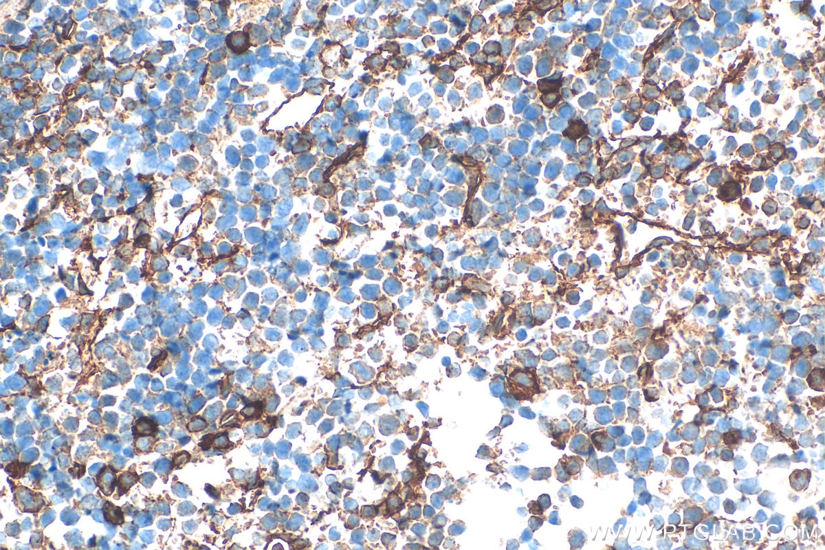 IHC staining of mouse spleen using 33313-1-AP Immunohistochemistry (IHC) staining of mouse spleen tissue using CD93 Polyclonal antibody (33313-1-AP)
