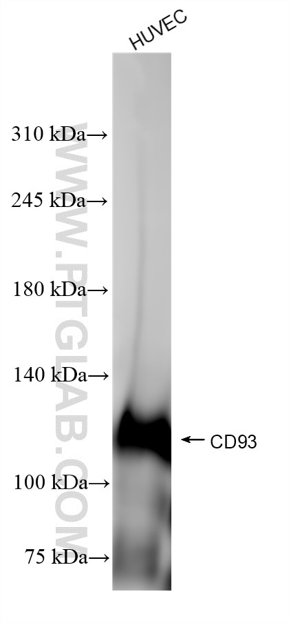 Western Blot (WB) analysis of HUVEC cells using CD93 Recombinant antibody (84945-4-RR)