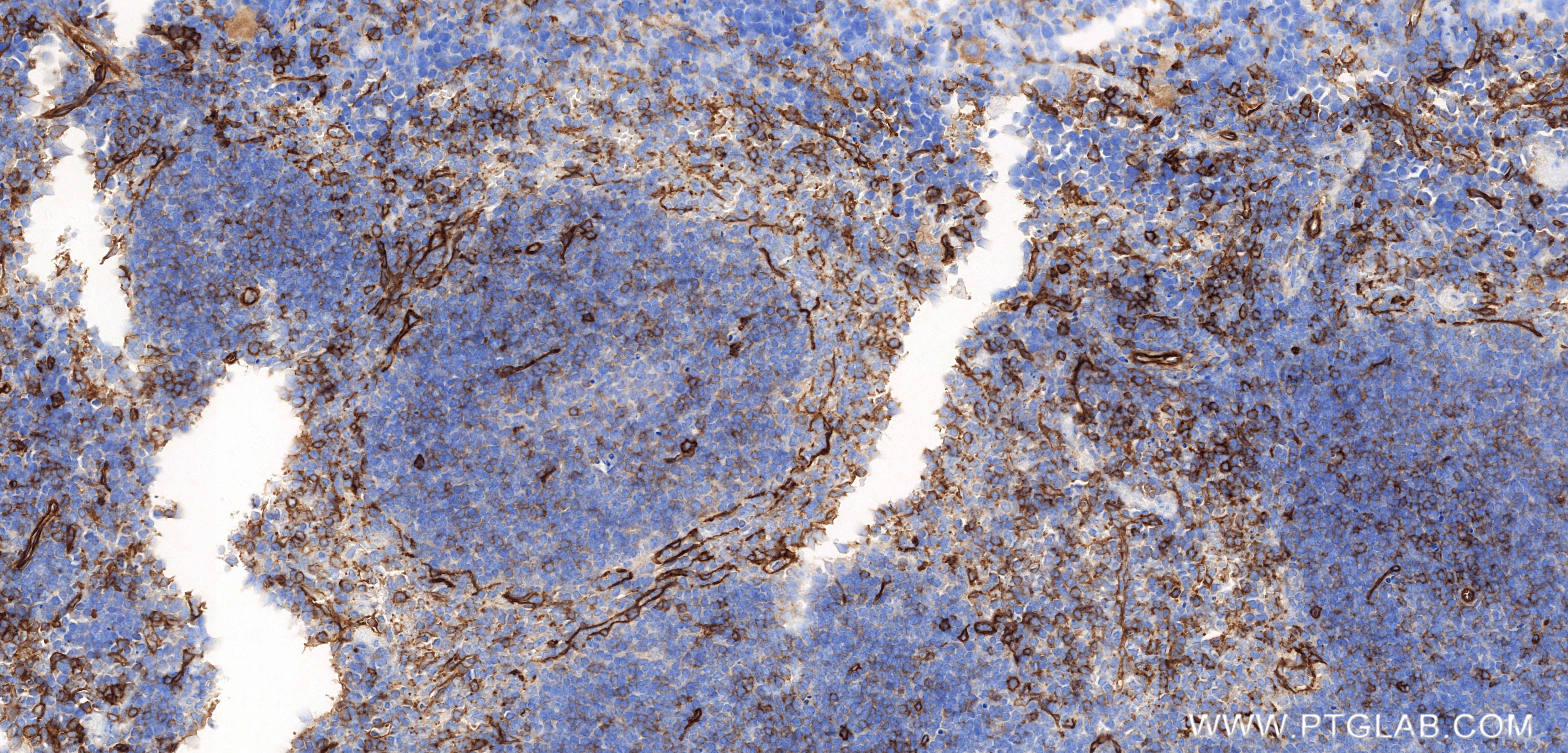 Immunohistochemistry (IHC) staining of mouse spleen tissue using CD93 Recombinant monoclonal antibody (86071-4-RR)