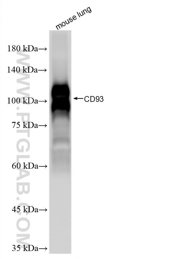 Western Blot (WB) analysis of mouse lung tissue using CD93 Recombinant monoclonal antibody (86071-4-RR)