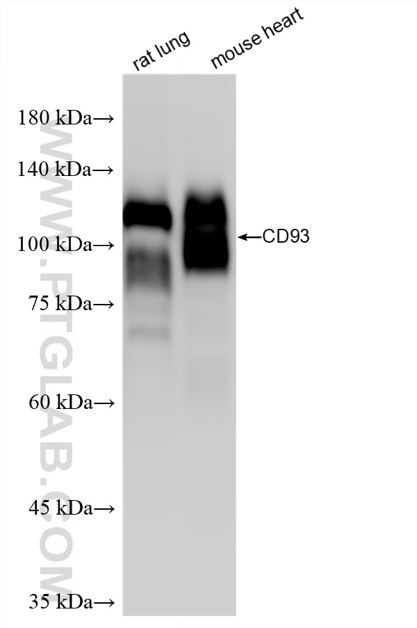 Western Blot (WB) analysis of various lysates using CD93 Recombinant monoclonal antibody (86071-4-RR)