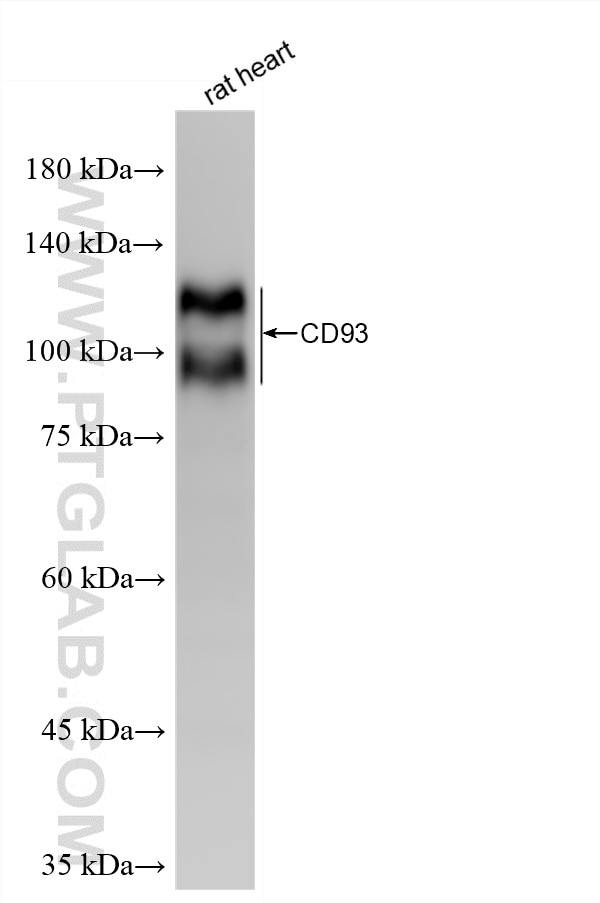 Western Blot (WB) analysis of rat heart tissue using CD93 Recombinant monoclonal antibody (86071-4-RR)