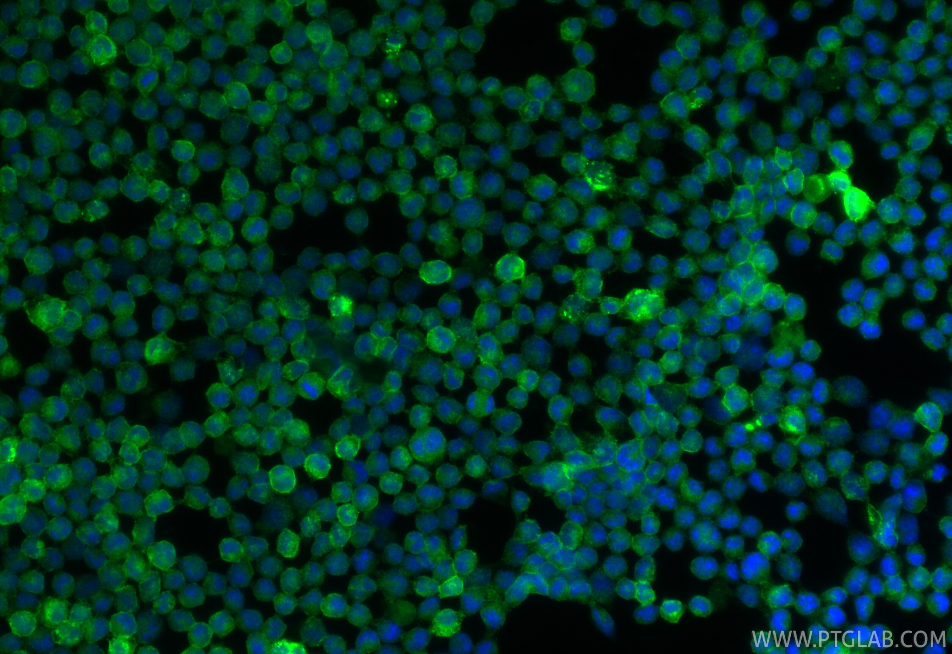 Immunofluorescence (IF) / fluorescent staining of CTLL-2 cells using CD96 Polyclonal antibody (34031-1-AP)