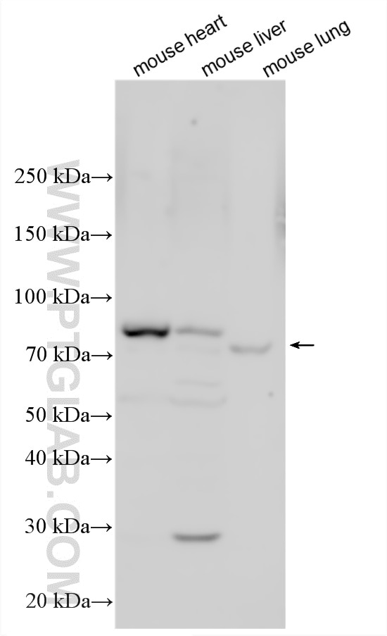 Western Blot (WB) analysis of various lysates using CD96 Polyclonal antibody (34031-1-AP)