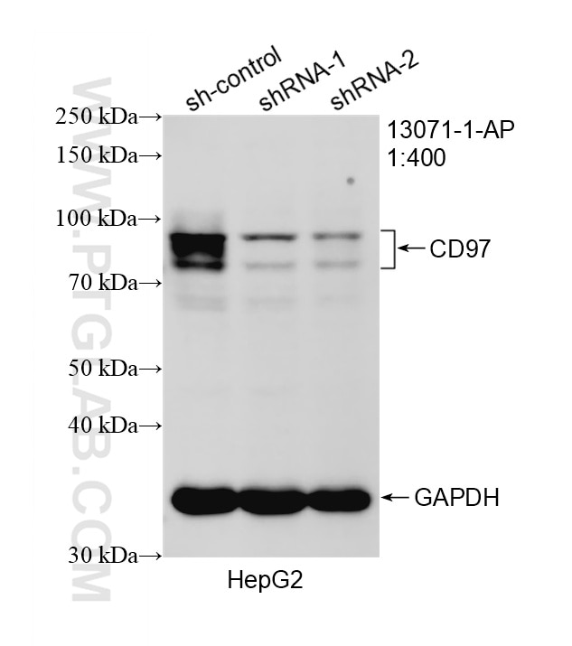 WB result of CD97 antibody (13071-1-AP; 1:400; incubated at room temperature for 1.5 hours) with sh-Control and sh-CD97 transfected HepG2 cells. Western Blot (WB) analysis of HepG2 cells using CD97 Polyclonal antibody (13071-1-AP)