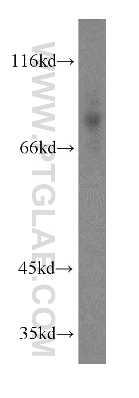 Western Blot (WB) analysis of Jurkat cells using CD97 Polyclonal antibody (13071-1-AP)