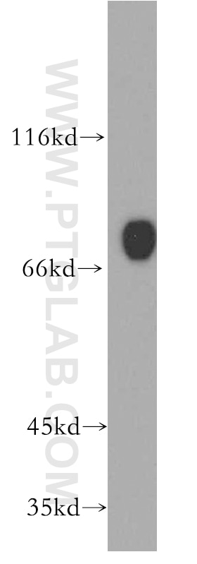 Western Blot (WB) analysis of K-562 cells using CD97 Polyclonal antibody (13071-1-AP)