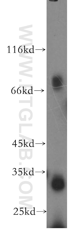 Western Blot (WB) analysis of U-937 cells using CD97 Polyclonal antibody (13071-1-AP)
