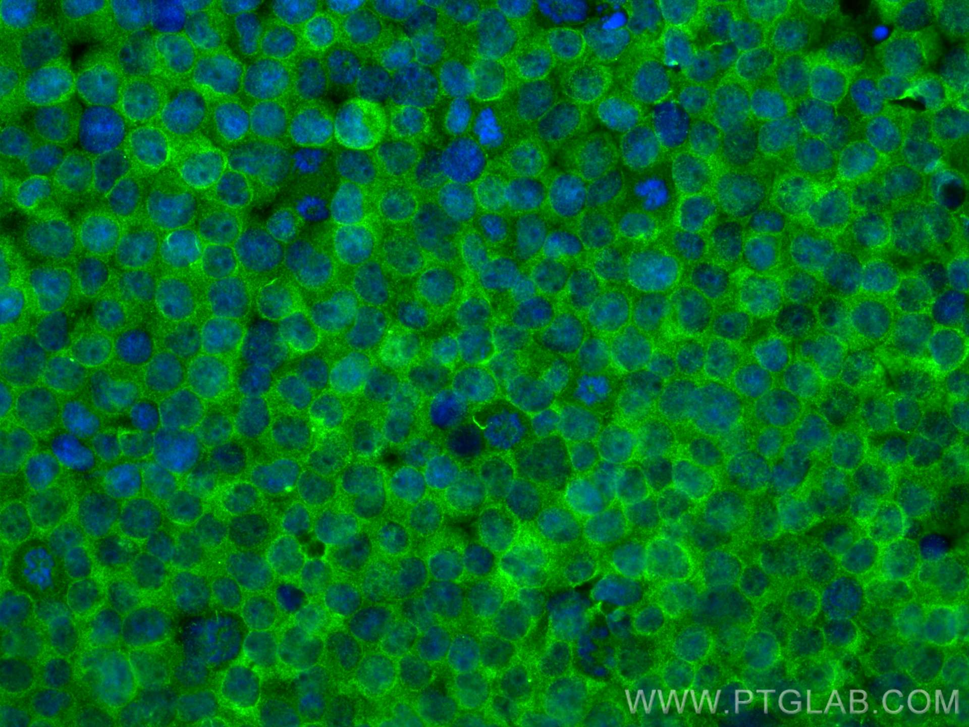Immunofluorescence (IF) / fluorescent staining of Jurkat cells using CD97 Monoclonal antibody (66972-1-Ig)