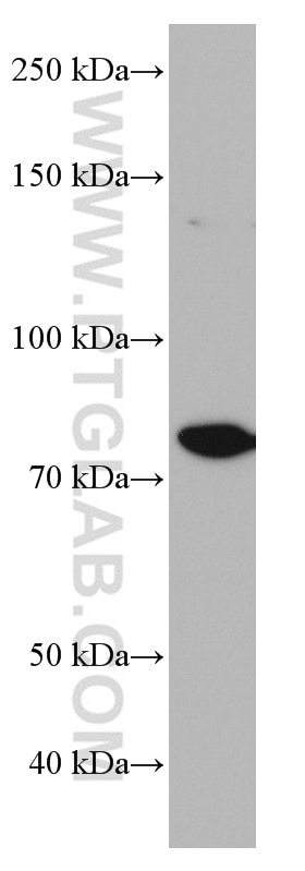 Western Blot (WB) analysis of HepG2 cells using CD97 Monoclonal antibody (66972-1-Ig)