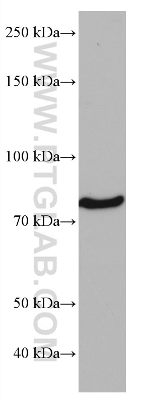 Western Blot (WB) analysis of K-562 cells using CD97 Monoclonal antibody (66972-1-Ig)