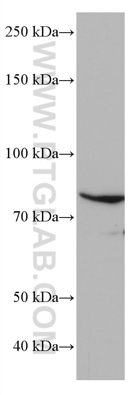 Western Blot (WB) analysis of HL-60 cells using CD97 Monoclonal antibody (66972-1-Ig)