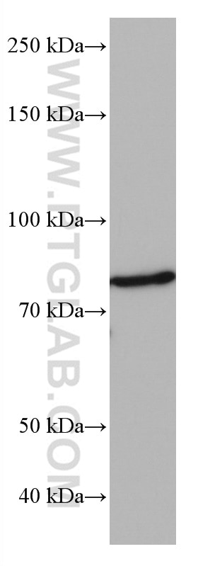 Western Blot (WB) analysis of DC2.4 cells using CD97 Monoclonal antibody (66972-1-Ig)