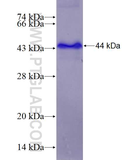 CD97 fusion protein Ag27991 SDS-PAGE