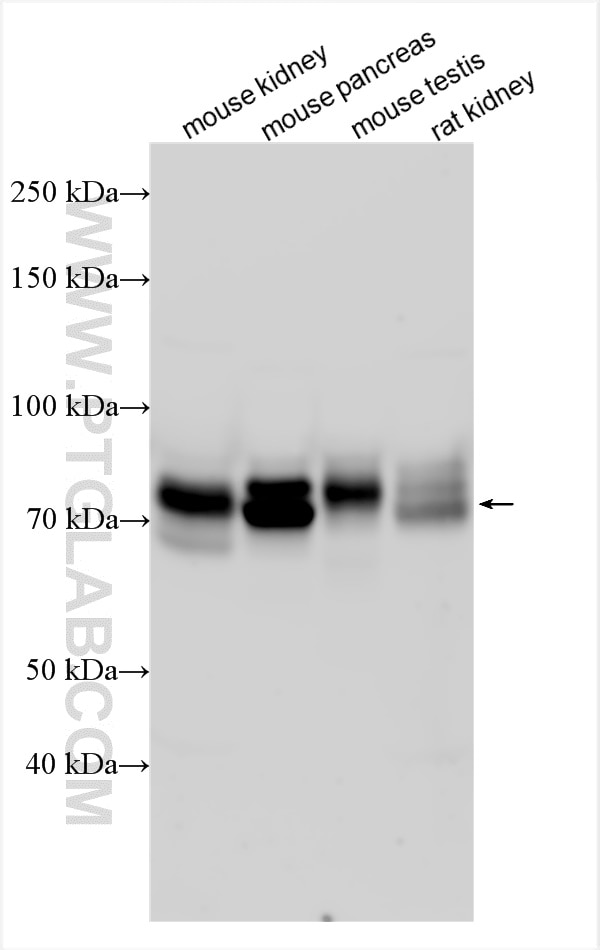 Western Blot (WB) analysis of various lysates using CD98/SLC3A2 Polyclonal antibody (31865-1-AP)