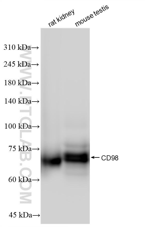 Western Blot (WB) analysis of various lysates using CD98/SLC3A2 Recombinant antibody (84040-6-RR)