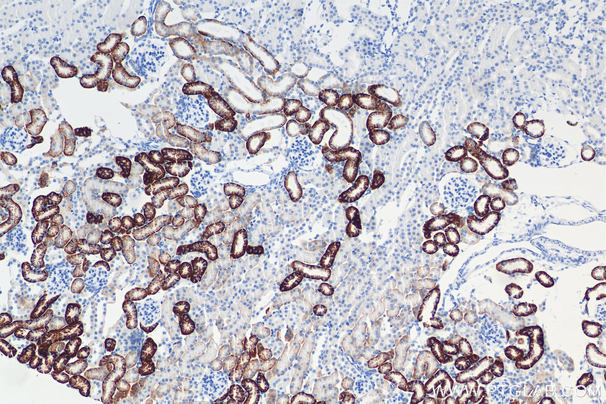 Immunohistochemistry (IHC) staining of mouse kidney tissue using CD98 Recombinant antibody (84040-7-RR)