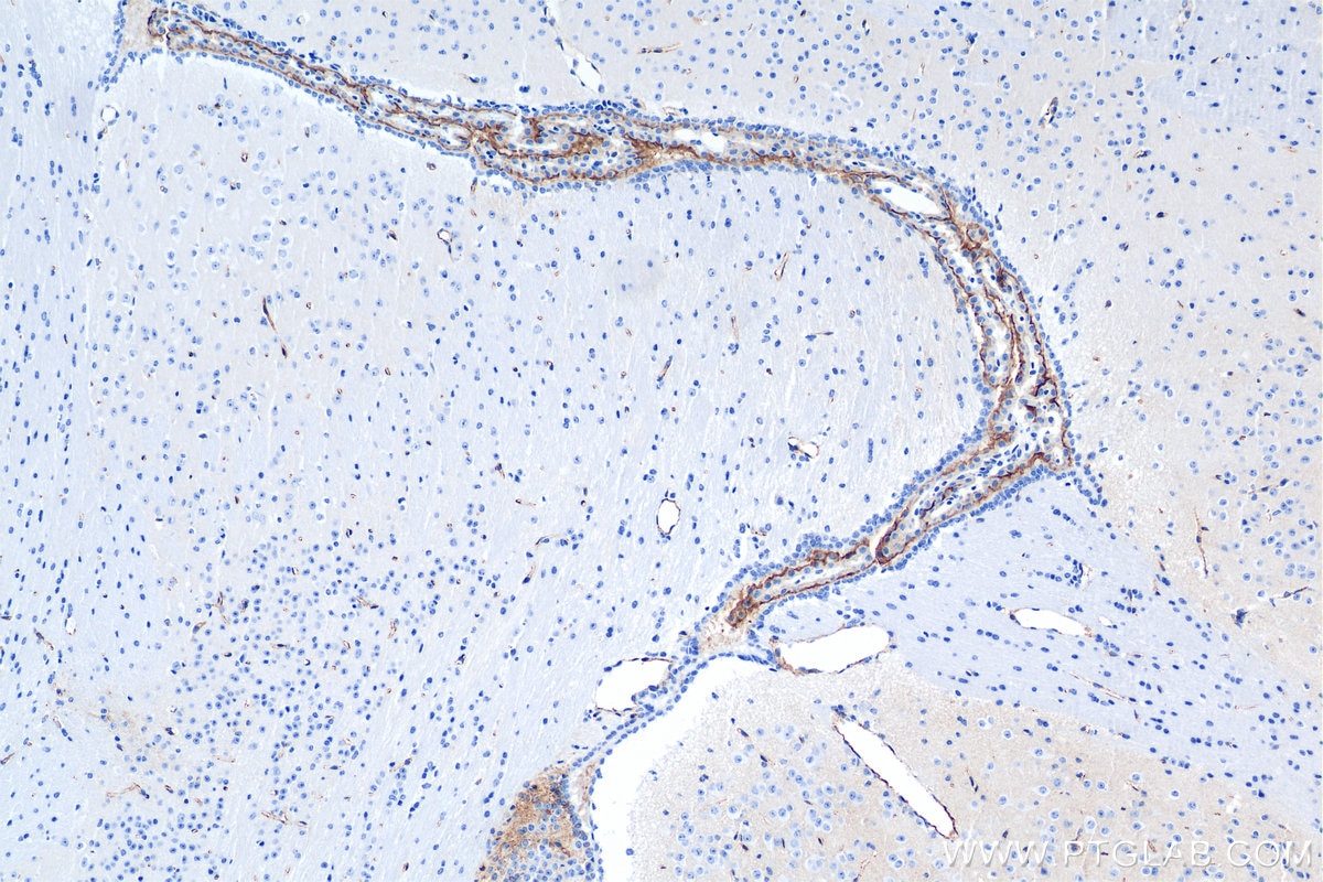 Immunohistochemistry (IHC) staining of mouse brain tissue using CD98 Recombinant antibody (84040-7-RR)