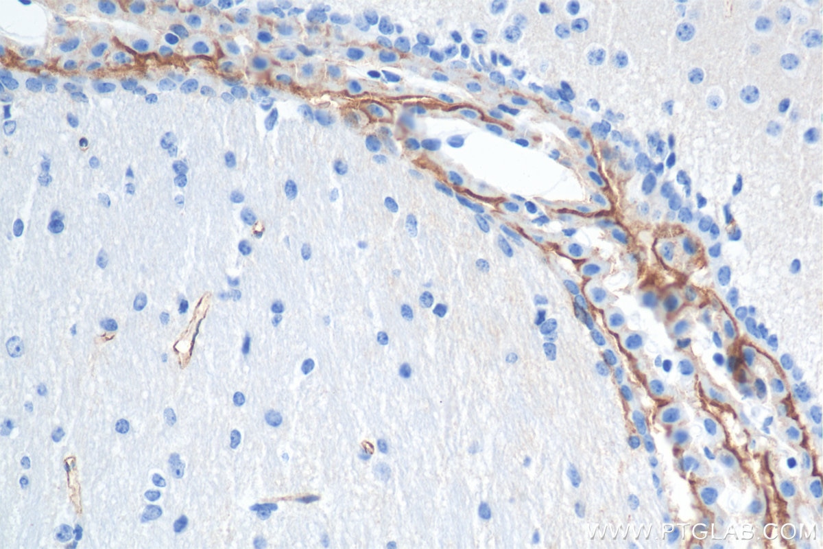 Immunohistochemistry (IHC) staining of mouse brain tissue using CD98 Recombinant antibody (84040-7-RR)