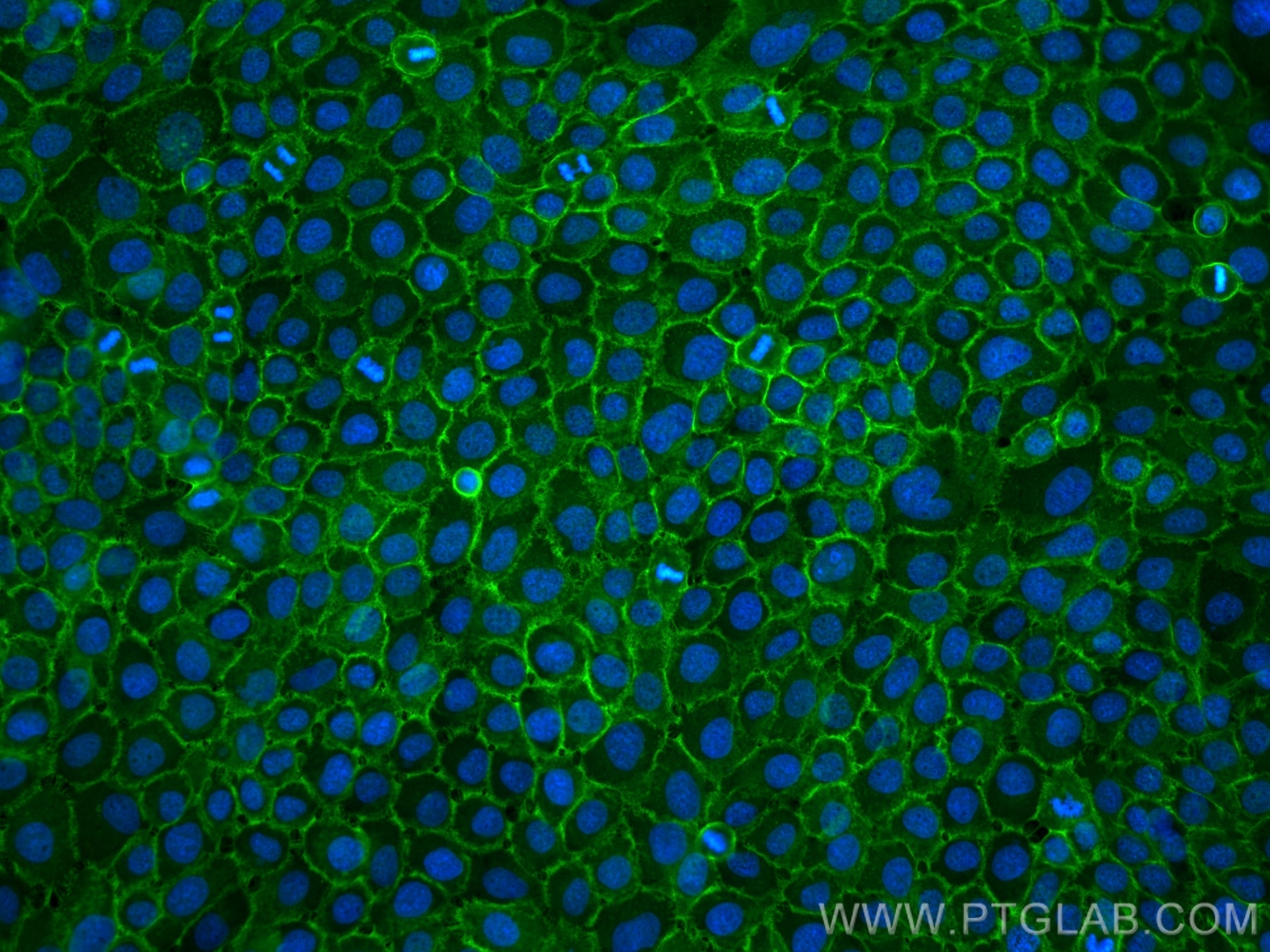 Immunofluorescence (IF) / fluorescent staining of A431 cells using CD98/SLC3A2 Recombinant antibody (84387-6-RR)