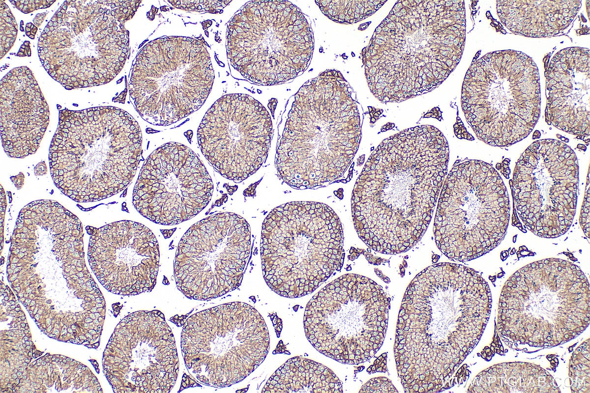 Immunohistochemistry (IHC) staining of mouse testis tissue using CD98/SLC3A2 Polyclonal antibody (32010-1-AP)