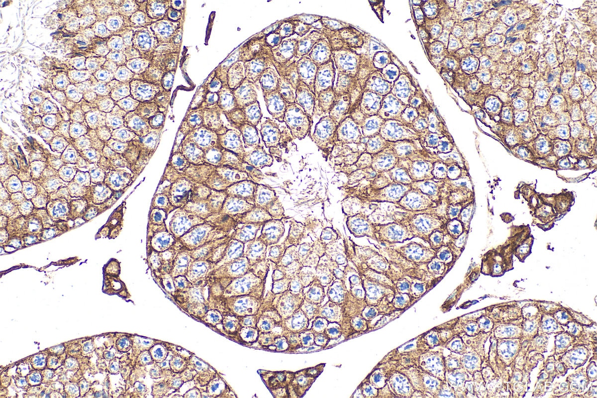 Immunohistochemistry (IHC) staining of mouse testis tissue using CD98/SLC3A2 Polyclonal antibody (32010-1-AP)