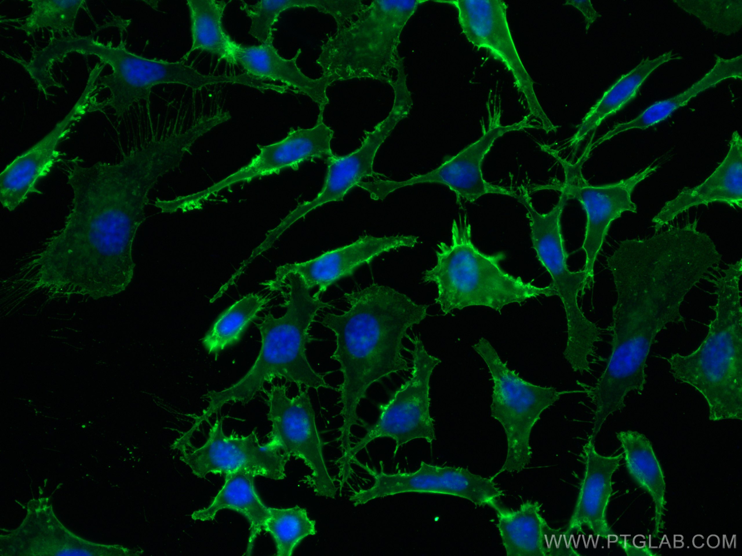 Immunofluorescence (IF) / fluorescent staining of HeLa cells using CD98/SLC3A2 Monoclonal antibody (66883-1-Ig)