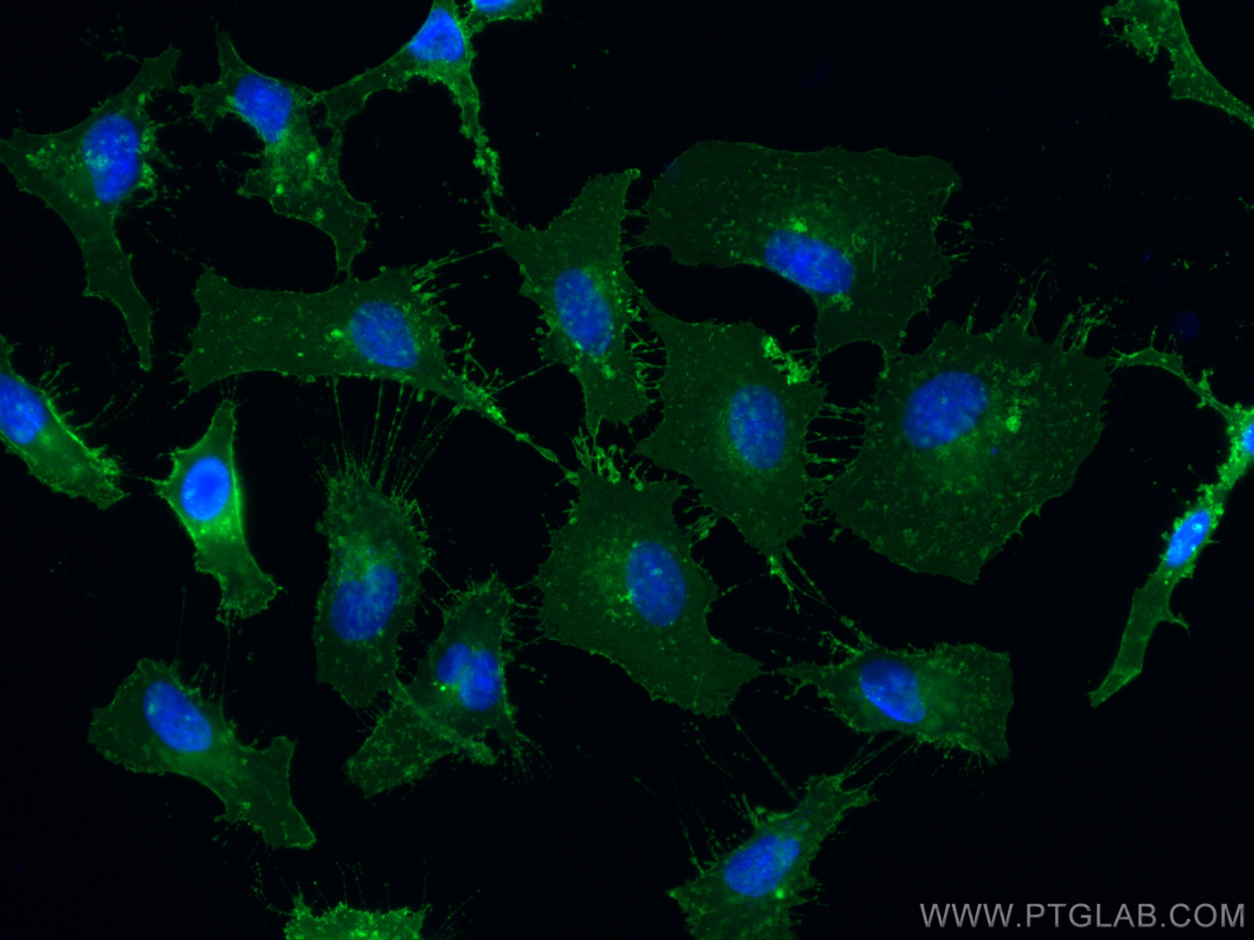 Immunofluorescence (IF) / fluorescent staining of HeLa cells using CoraLite® Plus 488-conjugated CD98/SLC3A2 Monoclon (CL488-66883)